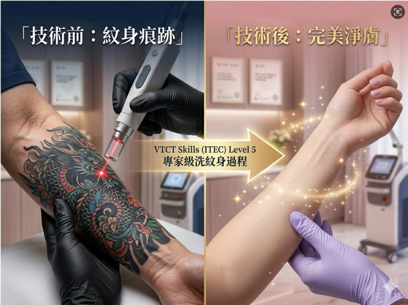 完成ITEC Level 4激光升級！直攻VTCT ITEC Level 5 國際激光洗紋身證書（RQF/EQF Level 5），香港美業頂尖技術必選 #10