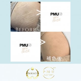 BIOTOUCH x PMUCELL CERTIFICATE 洗眉及皮膚色素重建術