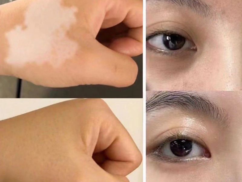 VTCT ITEC Level 5 偽裝行為藝術與膚色重建課程